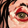 Blackeye